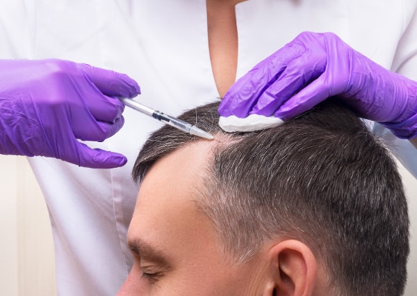 Stem Cell For Hair Regeneration